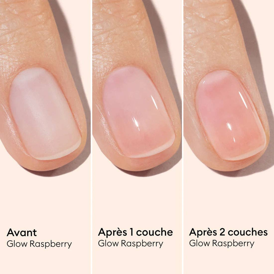 Before and after comparison of &