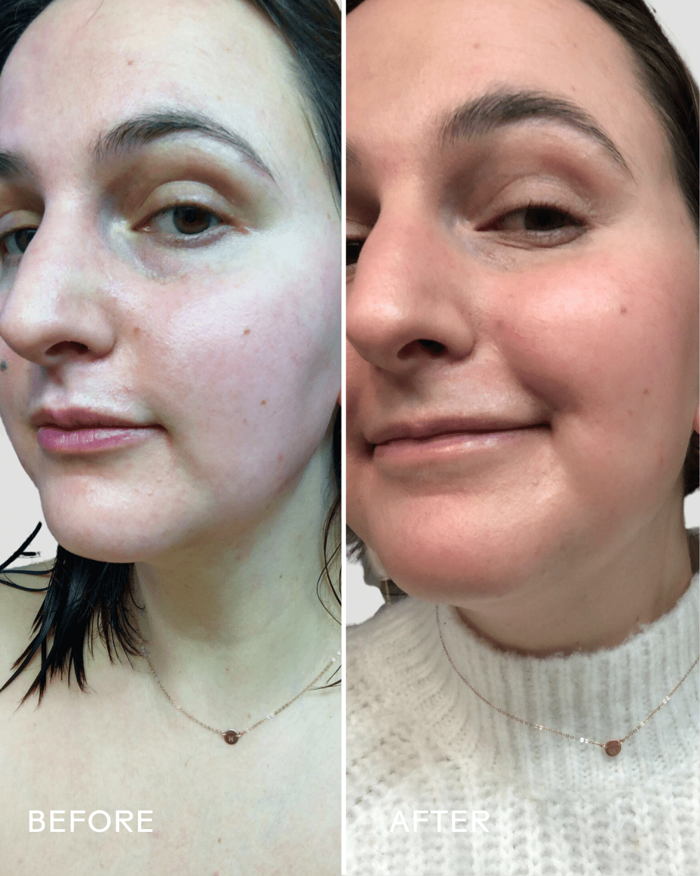 Boost 49% Rosehip Oil Serum - Echo Market