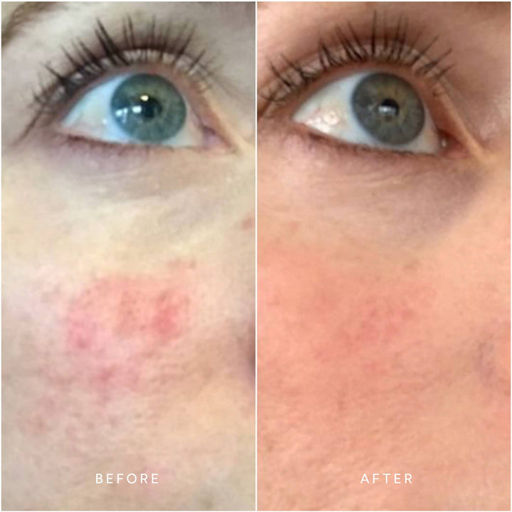 Calm Pure Radiance Oil - Echo Market