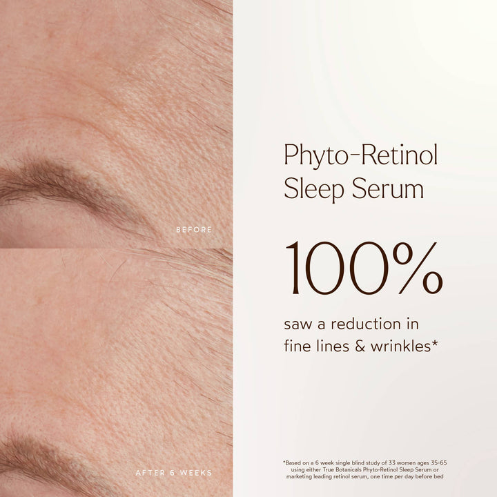Advertisement for Phyto-Retinol Sleep Serum showing before and after effects on skin.