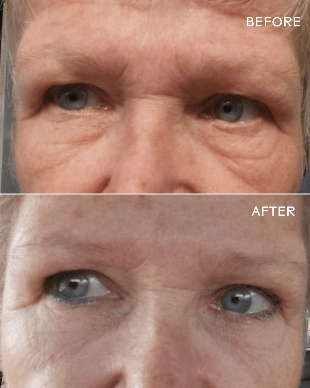 EyeHero™ Bio - Retinol Smoothing Eye Cream - Echo Market