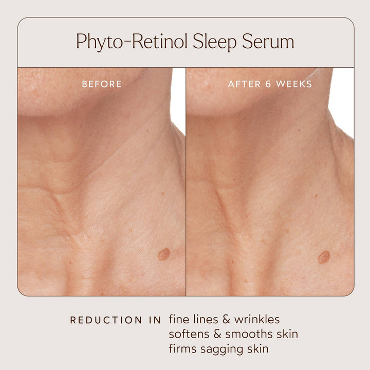 Before and after effect of Phyto-Retinol Sleep Serum on skin with text indicating improvements.