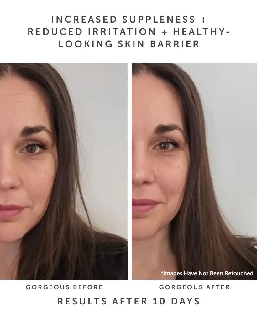 HORIZON | Ceramide Barrier Serum - Echo Market