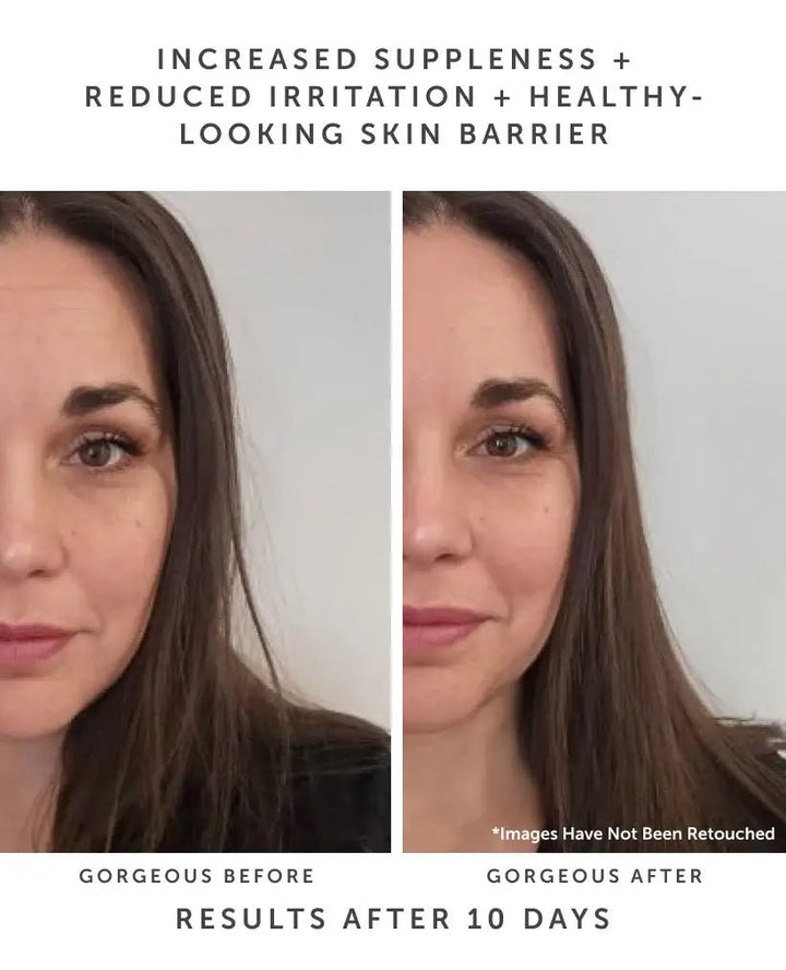 HORIZON | Ceramide Barrier Serum - Echo Market
