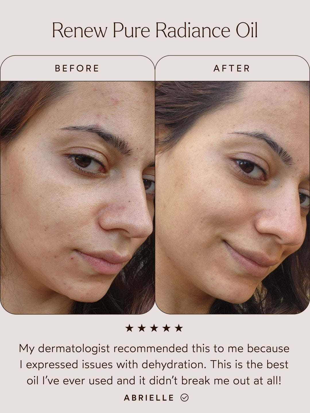 Before and after comparison of a woman&