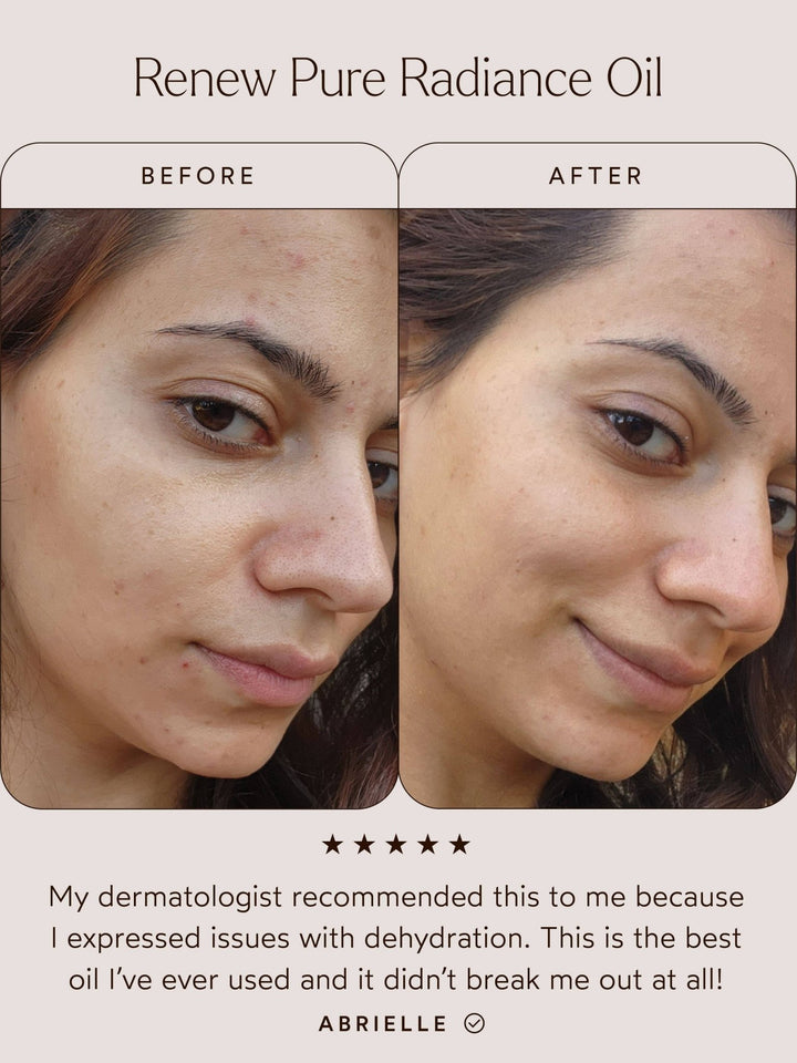 Before and after comparison of a woman&