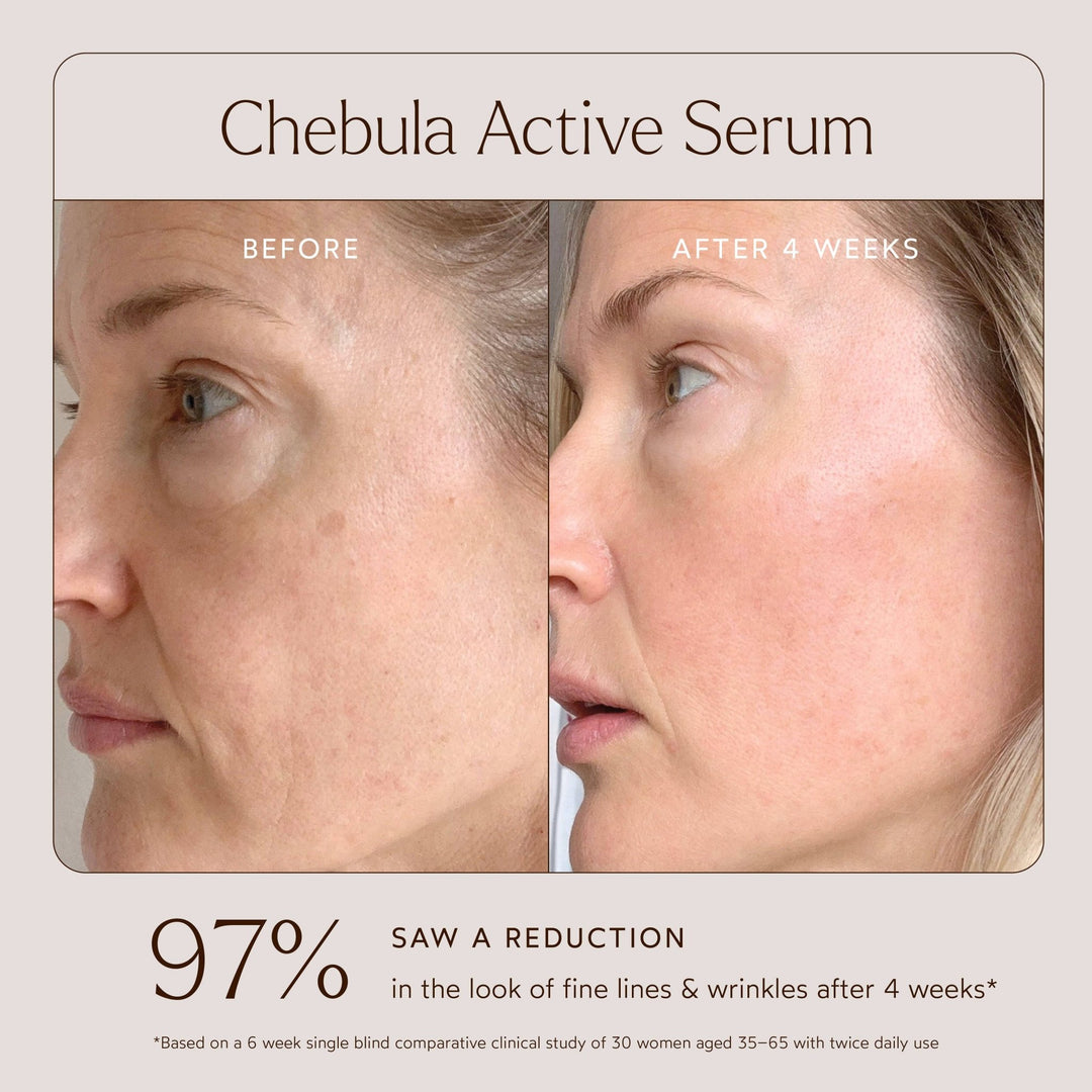 Before and after effect of Chebula Active Serum on a woman&