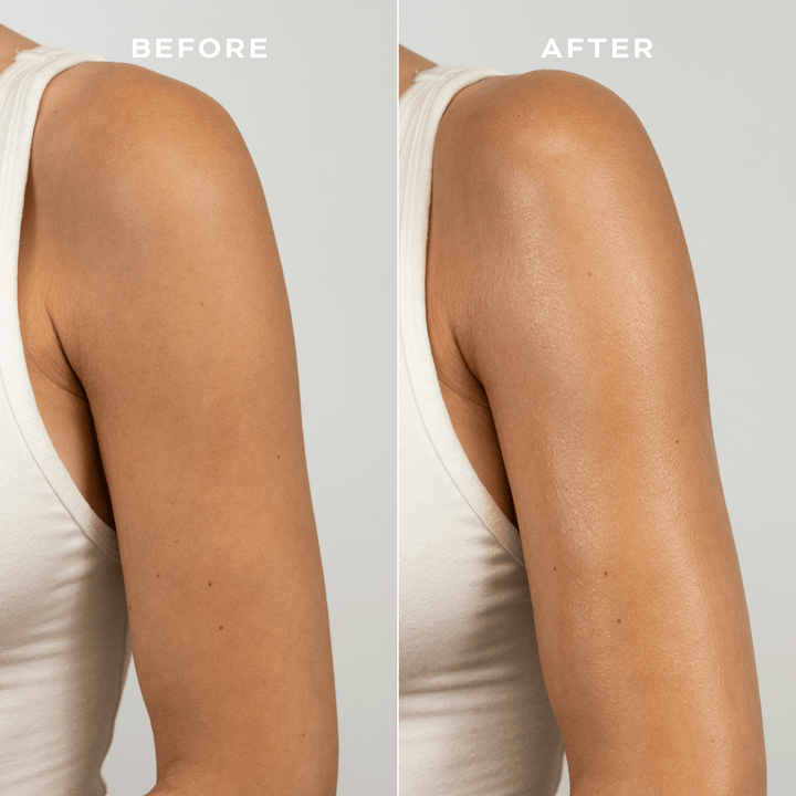 Before and after comparison of a woman&