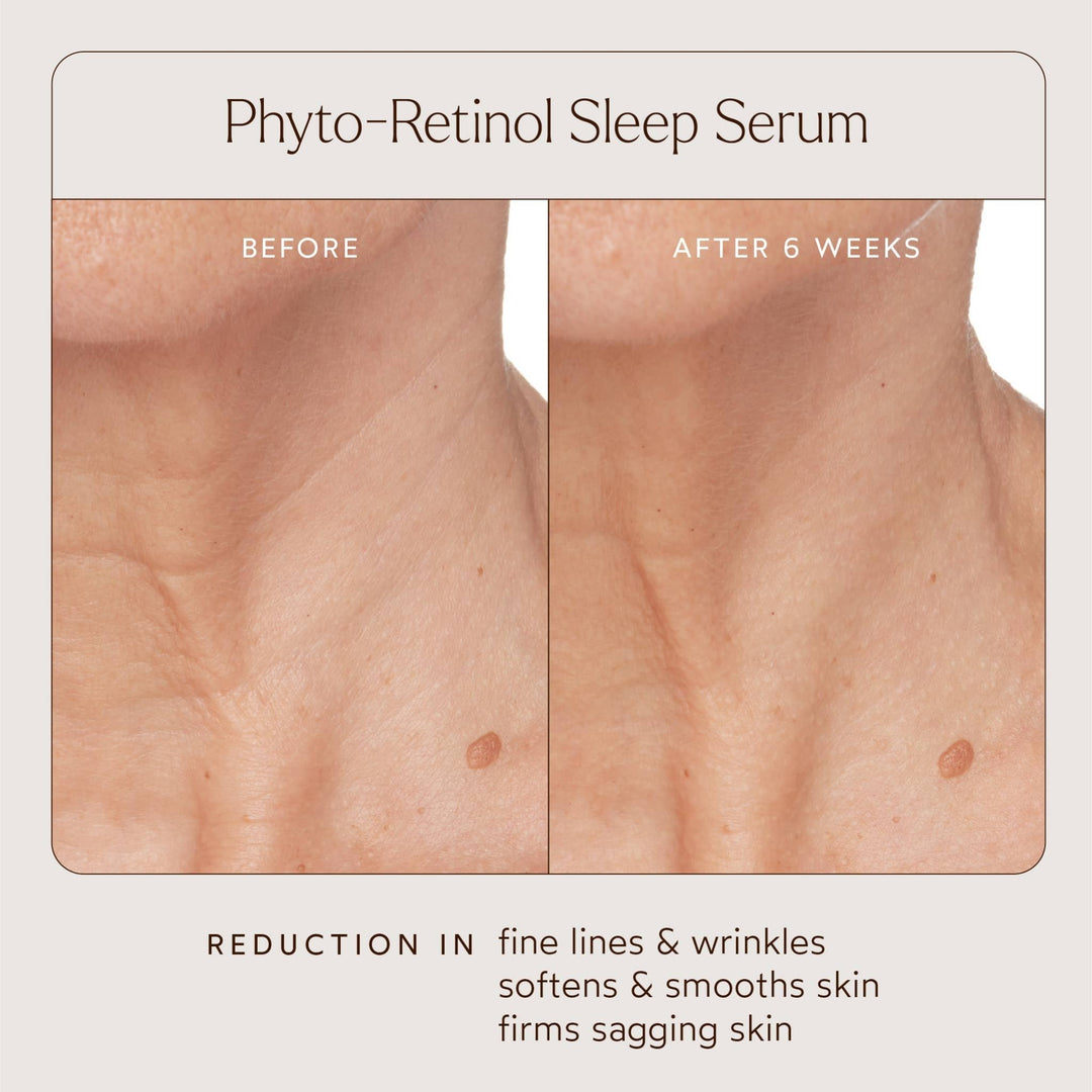 Phyto Retinol Anti - Aging Sleep Treatment - Echo Market