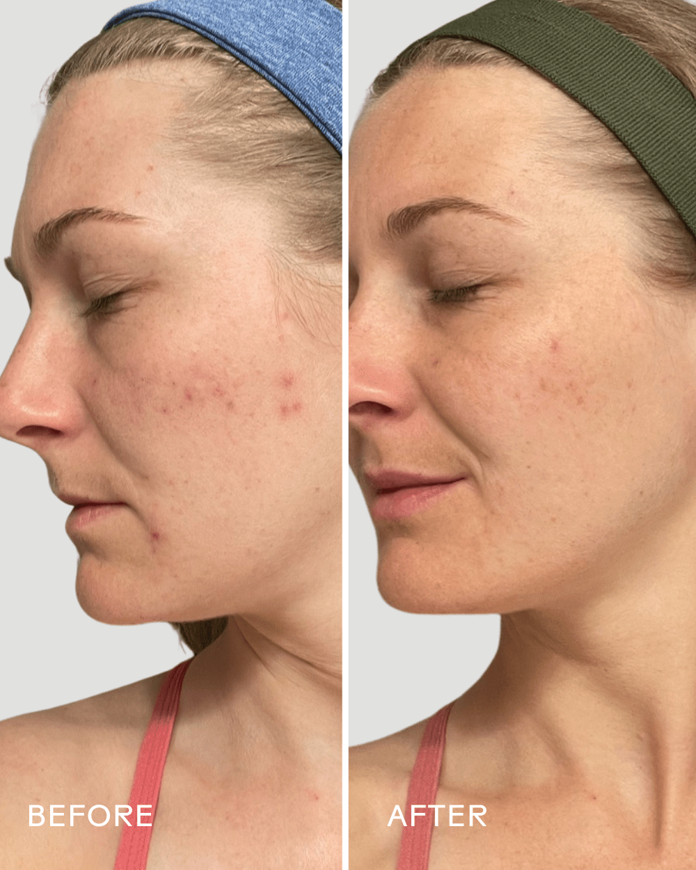 Refresh Papaya & Salicylic Acid Cleanser - Echo Market