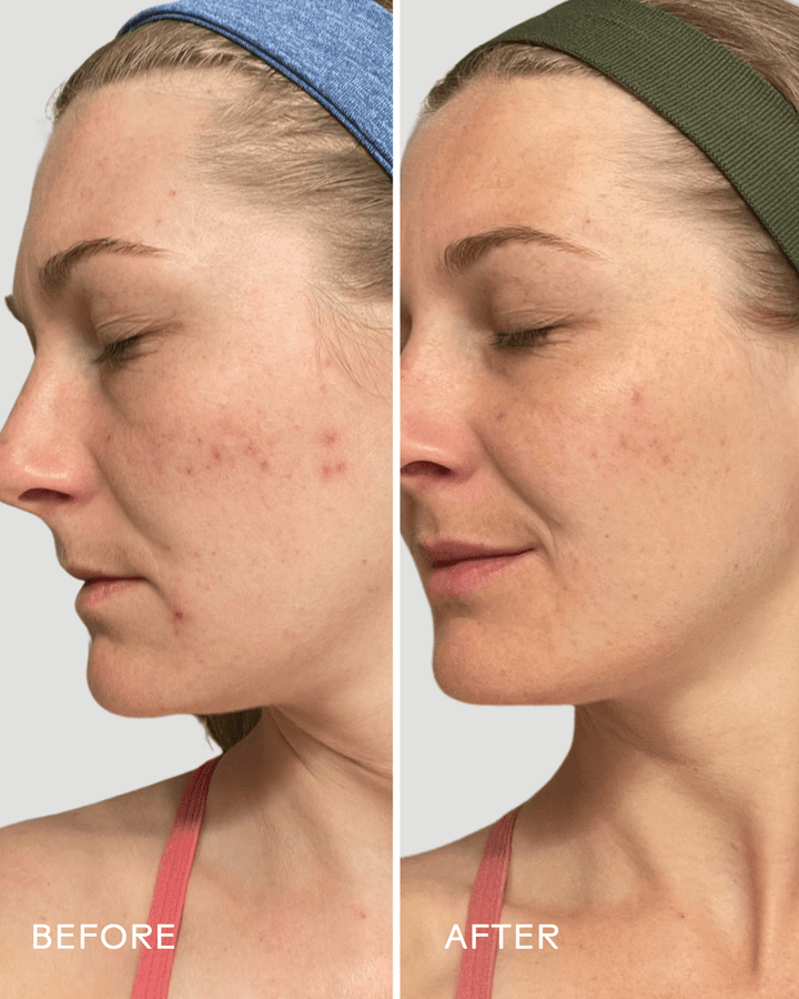 Refresh Papaya & Salicylic Acid Cleanser - Echo Market