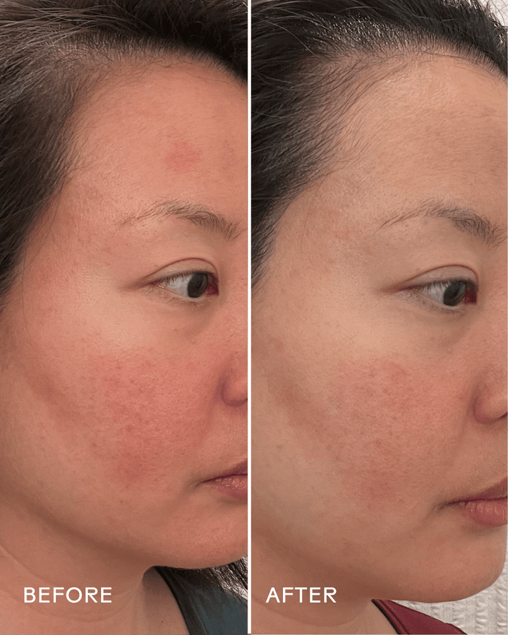 Replenish Ceramides & Blueberry Barrier Repair Serum - Echo Market