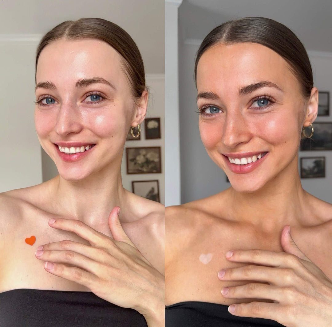 Before and after comparison of a woman with heart-shaped marks on her chest.