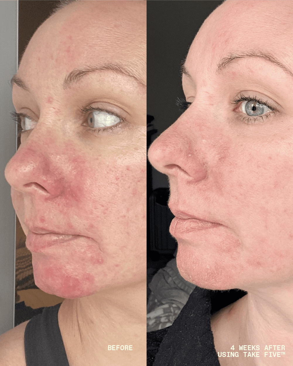 Take Five™ Hypochlorous Acid Balancing Body + Face Spray - Echo Market