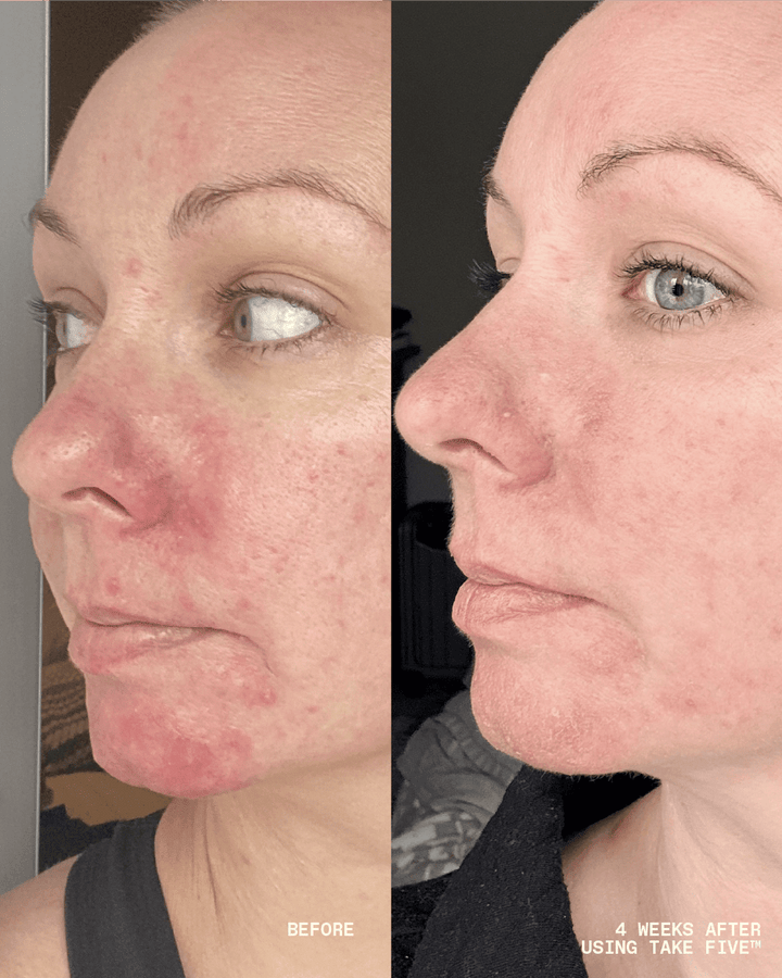 Take Five™ Hypochlorous Acid Balancing Body + Face Spray - Echo Market