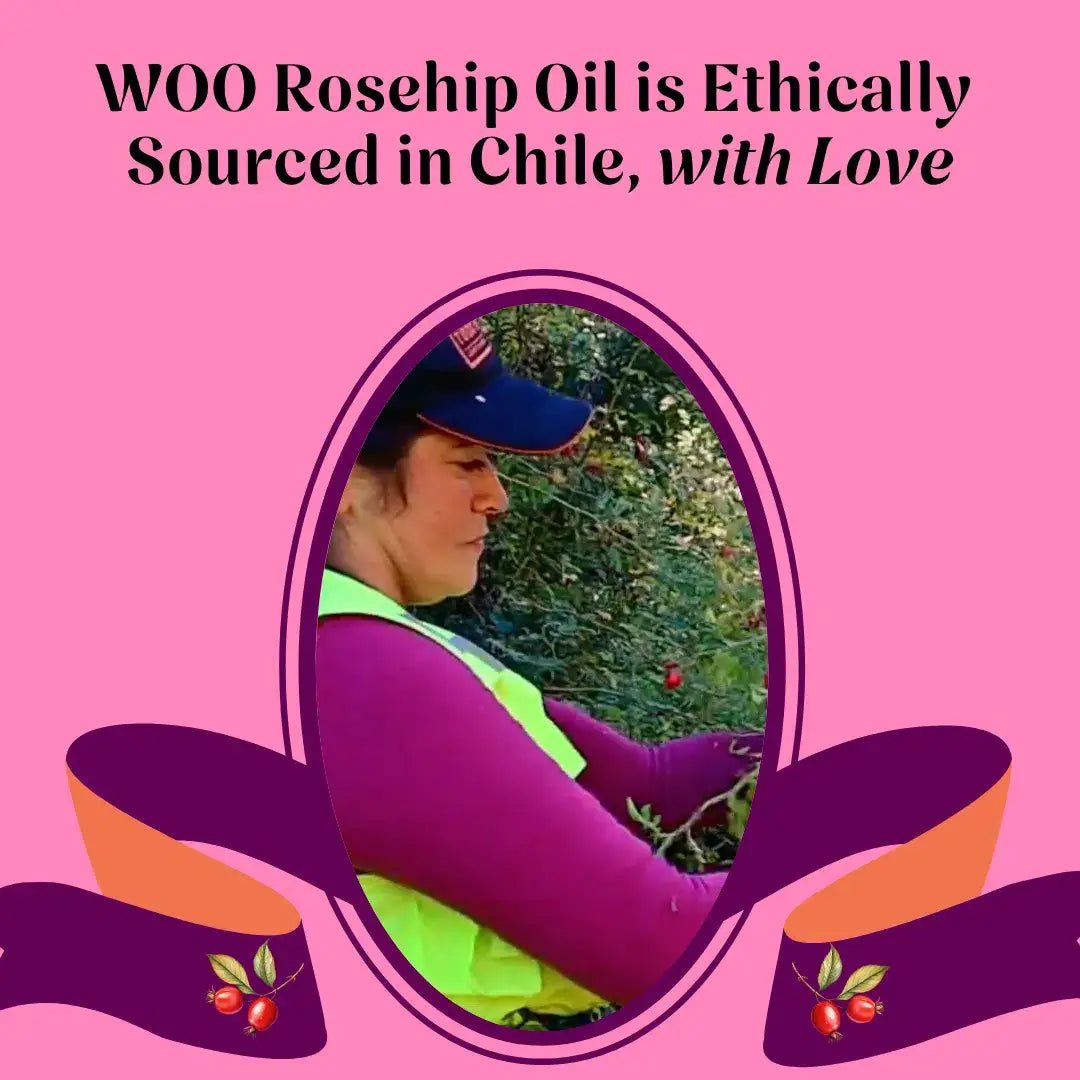 WOO™ Organic Rosehip Oil - Echo Market